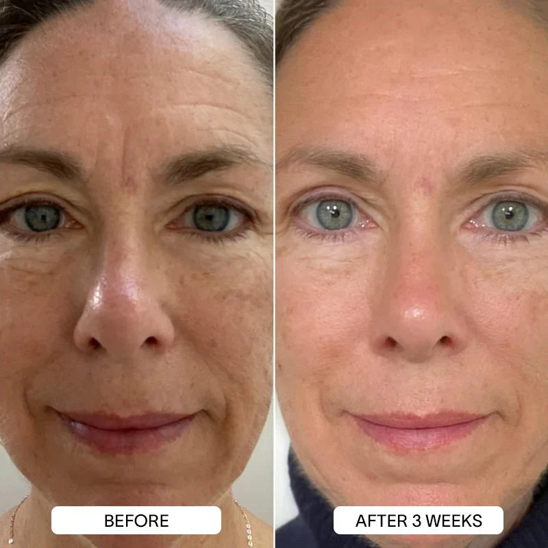 PureSkin 3% Hyaluronic Acid Moisturizing Serum