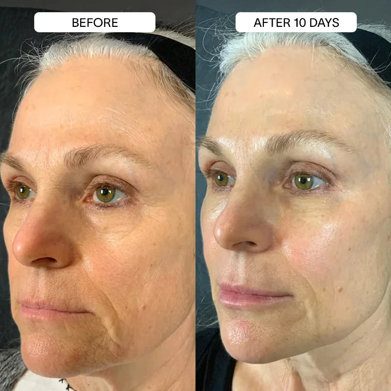 PureSkin 3% Hyaluronic Acid Moisturizing Serum