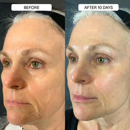 PureSkin 3% Hyaluronic Acid Moisturizing Serum