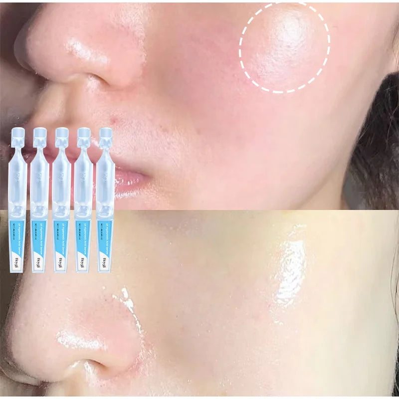 PureSkin 3% Hyaluronic Acid Moisturizing Serum