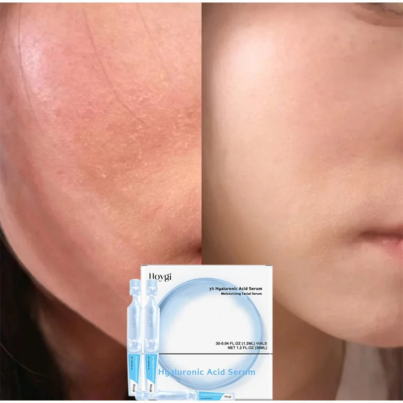 PureSkin 3% Hyaluronic Acid Moisturizing Serum